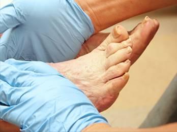 Diabetic Foot Care